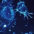 n CANCERCELLS541954 1280 large570